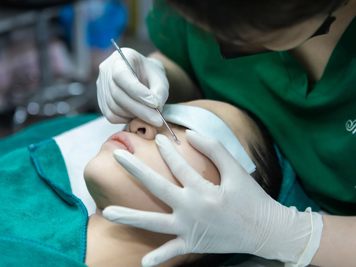 Kỹ thuật viên Mây Spa thực hiện lấy nhân mụn