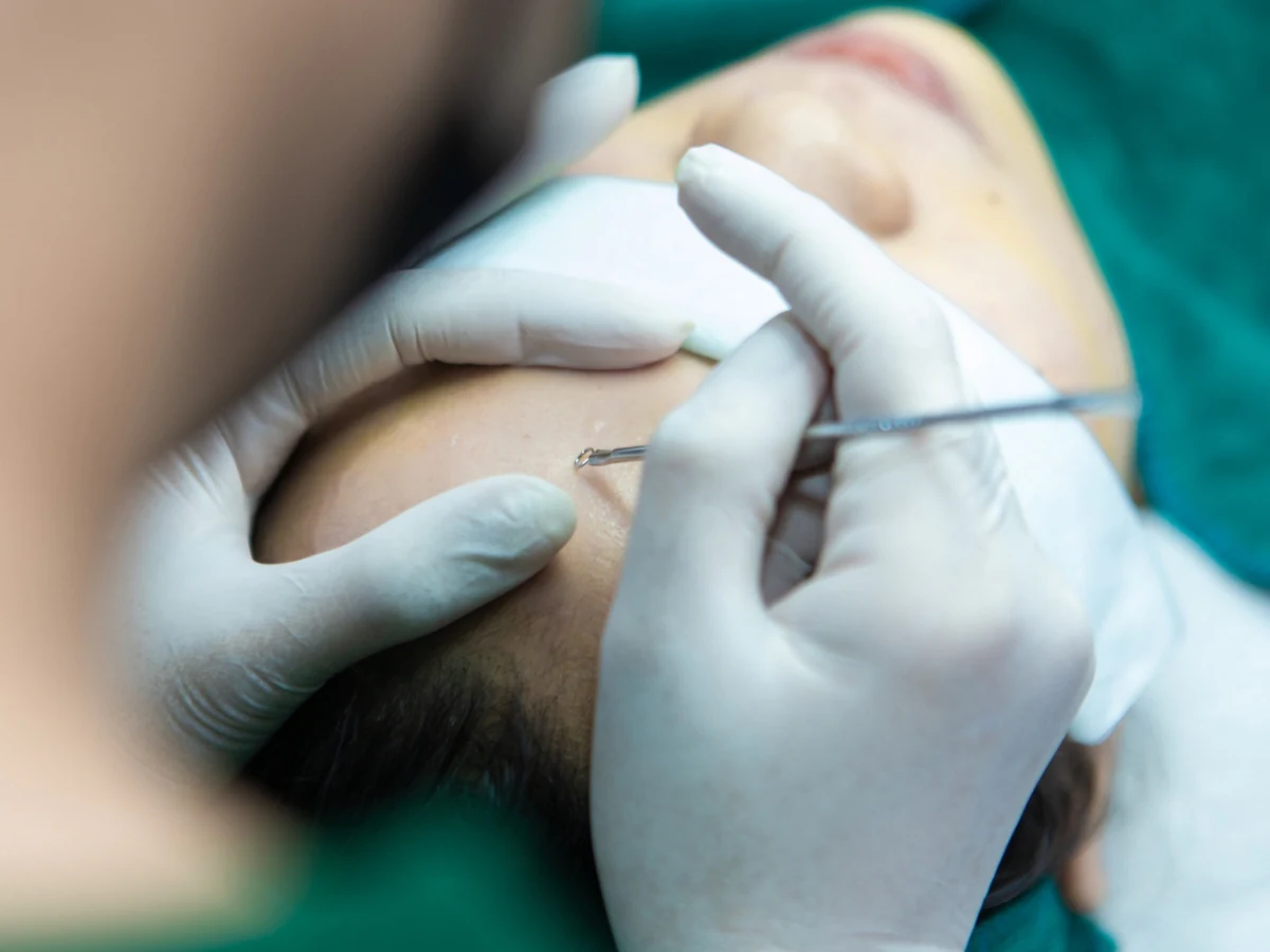 Hình ảnh quy trình chăm sóc da tại Mây Spa